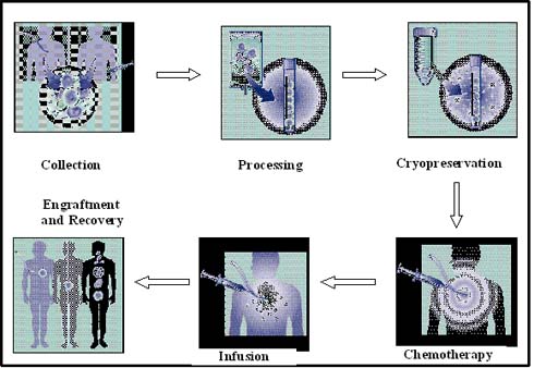 Figure 4: Stem cell transplantation process (adapted from Multiple Myeloma Research Foundation, 2004).