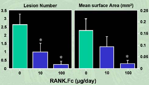 Figure 6: RANK-Fc inhibits the development of osteolytic lesions in myeloma-bearing mice (adapted from Oyajobi et al, 2005).