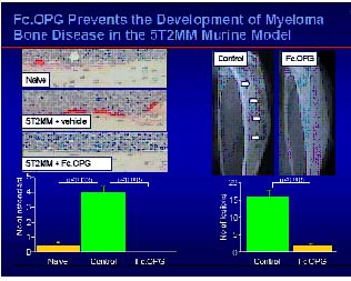 Figure 7: Fc-OPG prevents the development of myeloma bone disease in the 52TMM murine model (adapted from the slides of zolendric acid preclinical profile by Peter Croucher, University of Sheffield, UK, 2001).